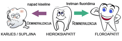 zalivanje fisura 