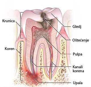 ENDODONCIJA 2