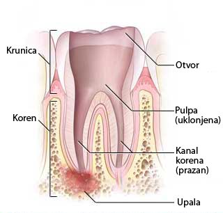 ENDODONCIJA 4