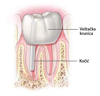 ENDODONCIJA 6