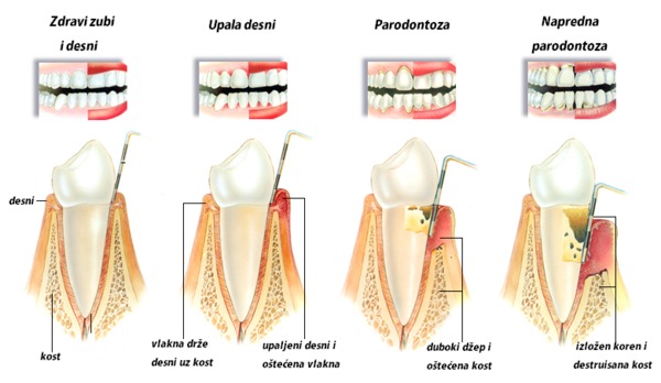 PARODONTOLOGIJA