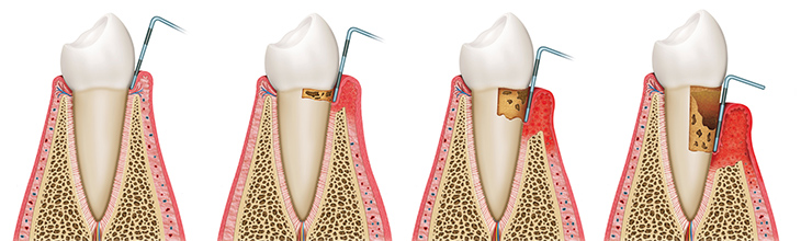 Endodoncija